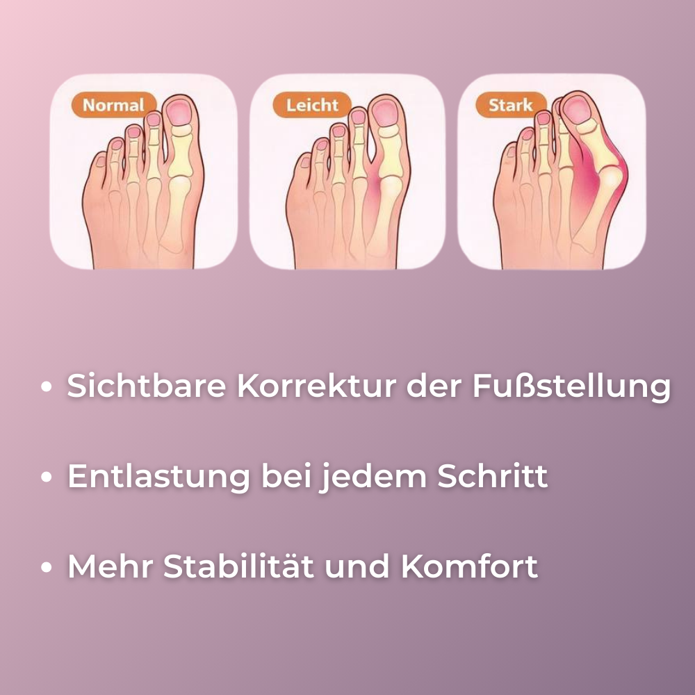 Fußgewölbe-Trainer