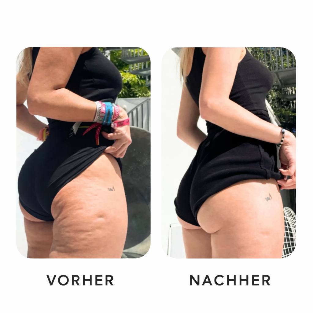 Elektrisches Vakuum-Massagegerät mit Wärme